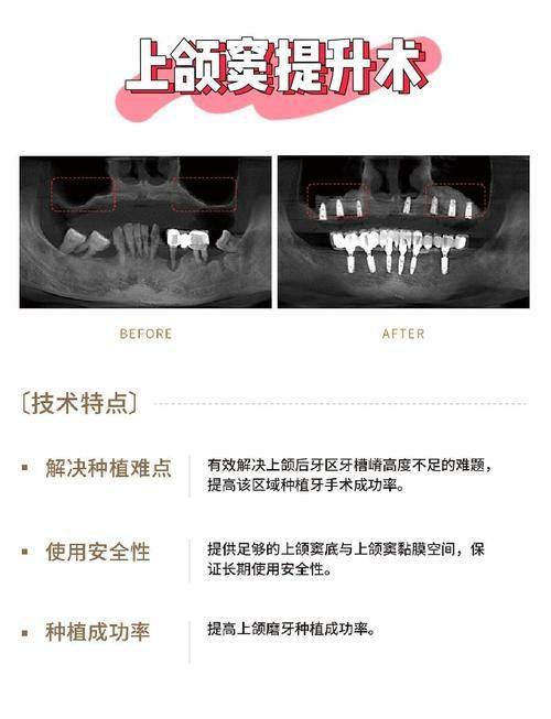 王朋娜医生擅长项目