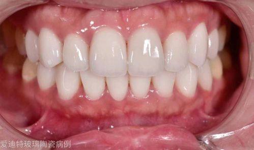 王朋娜医生技术优势