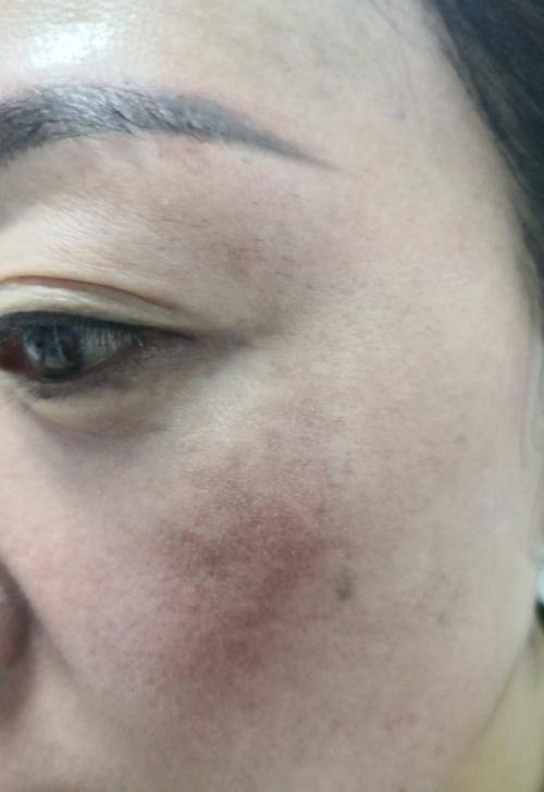 马小萍医生口碑评价及真人实例