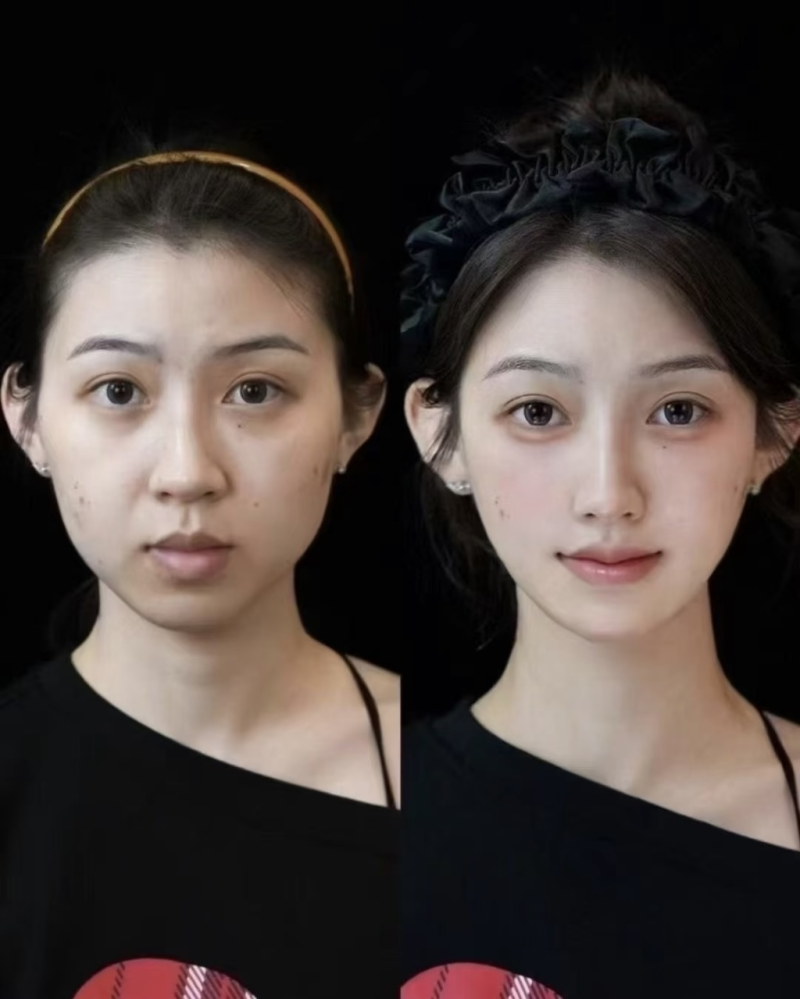 长春伊美整形医院详细的预约挂号方式及流程