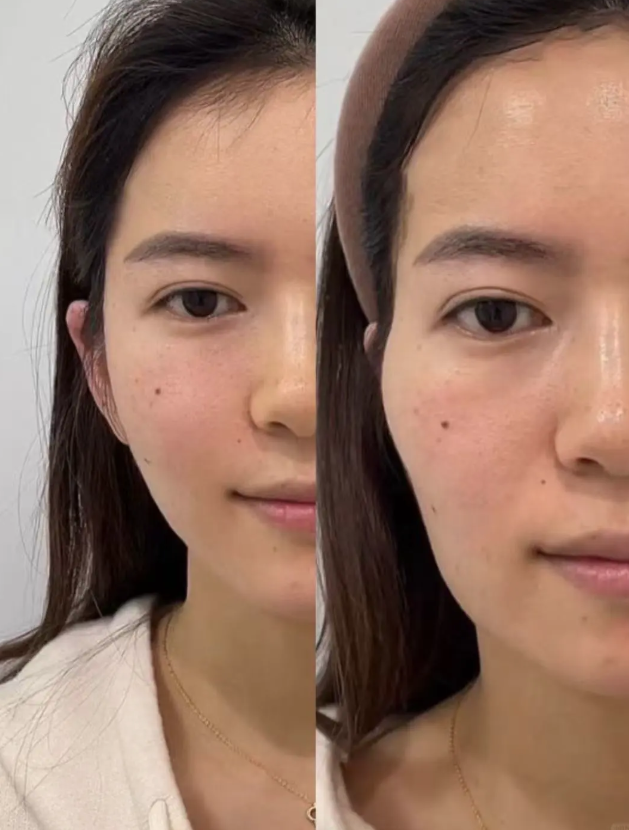 广州方明武医疗美容诊所真人口碑评价怎么样？