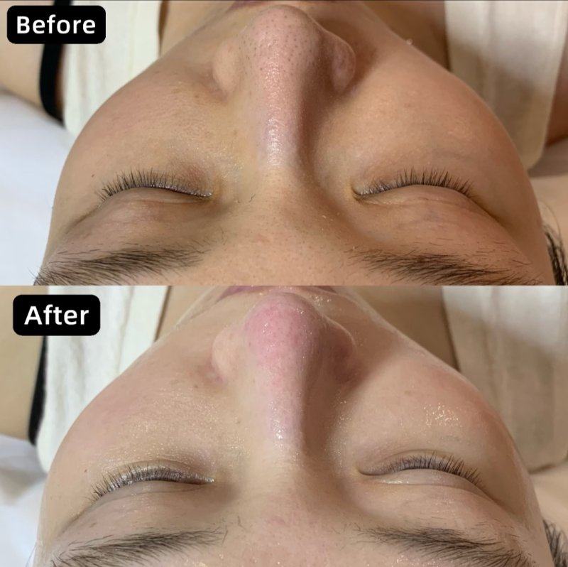 深圳美加美医疗美容整形门诊部收费价格表/收费标准