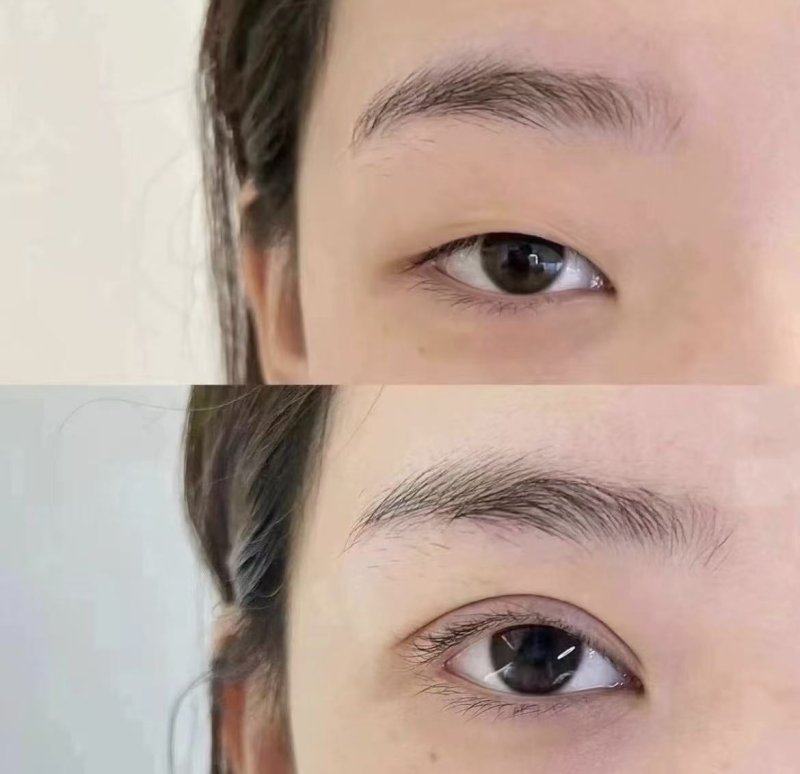 张久辉医生技术优势