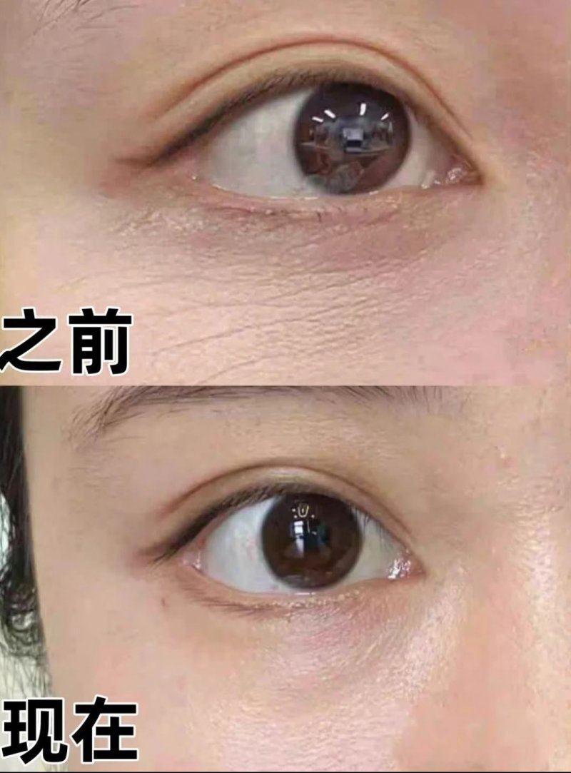 广州方明武医疗美容诊所特色项目及技术优势