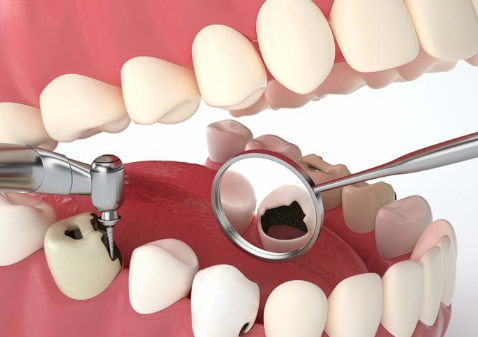 眉山仁寿幸福口腔诊所收费价格表/收费标准