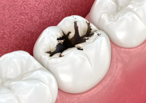 烟台圣牙贝南大街口腔门诊部真人口碑评价怎么样？