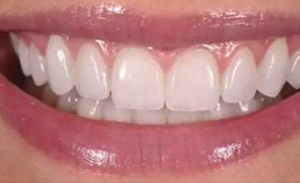 王朋娜医生擅长项目