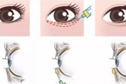 暨南大学附属深圳华侨医院医疗美容科详细的预约挂号方式及流程