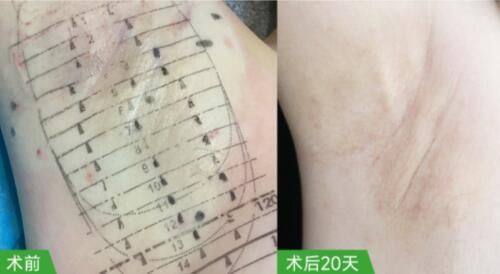 暨南大学附属深圳华侨医院医疗美容科地址电话营业时间