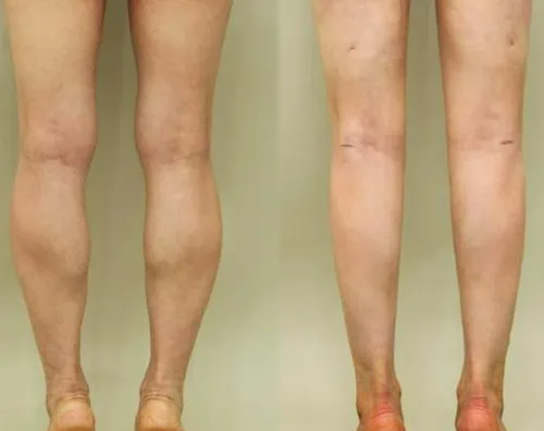 南京溯颜甄选医疗美容诊所真人口碑评价怎么样？