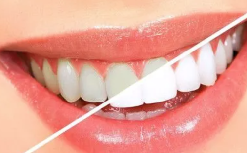 湖州沐洁口腔门诊部特色项目及技术优势