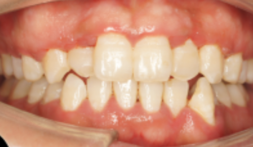 北京晴雪园雅德嘉口腔门诊部真人口碑评价怎么样？