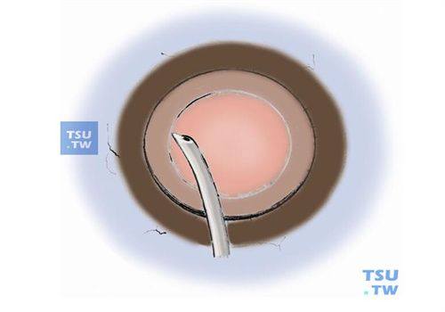黄冈市中医医院眼科医生团队实力强大及骨干医生简介