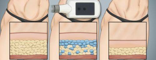 新乡媛美侬医美整形医院特色项目及技术优势