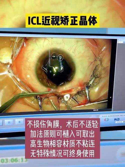 阜新何氏眼科医院特色项目及技术优势