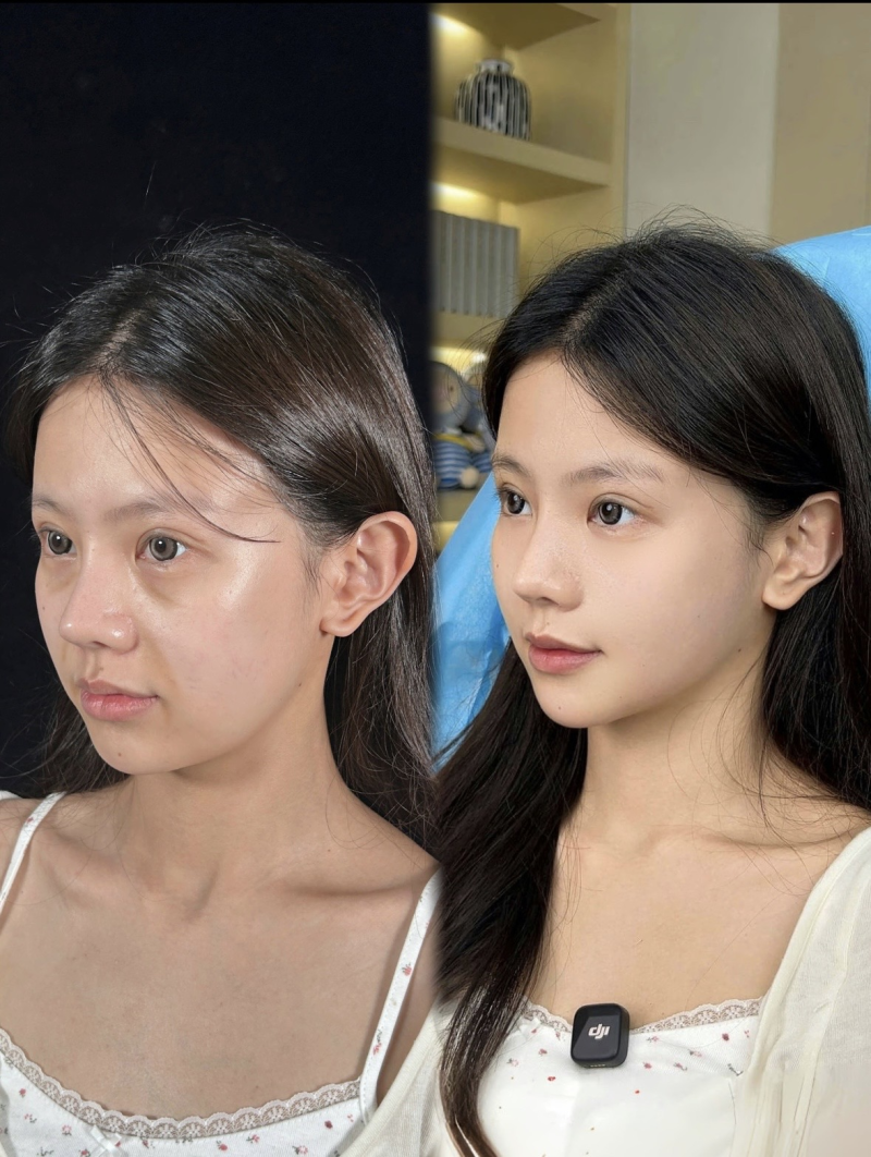 佐世保美肌诊所真人口碑评价怎么样？