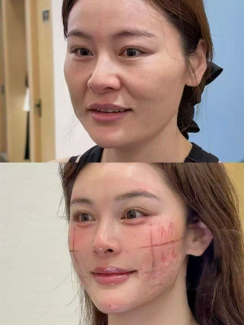 天津市公安医院美容中 心收费价格表/收费标准