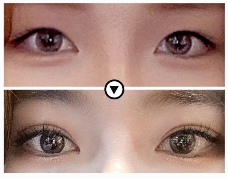 FACE-LINE整形外科医院收费价格表/收费标准