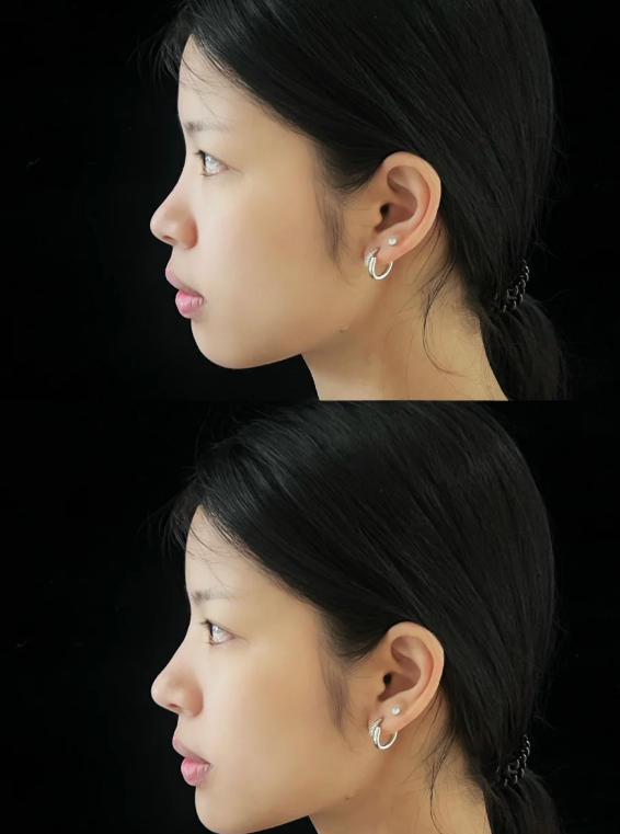 FACE-LINE整形外科医院是正规医院吗？