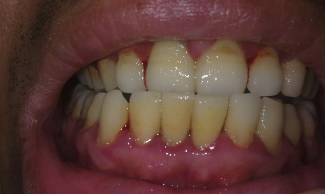 北京晴雪园雅德嘉口腔门诊部详细的预约挂号方式及流程