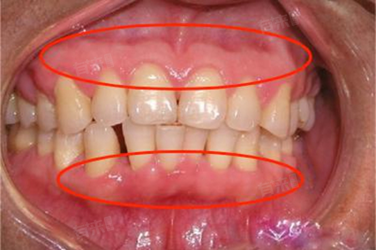 湖州沐洁口腔门诊部真人口碑评价怎么样？