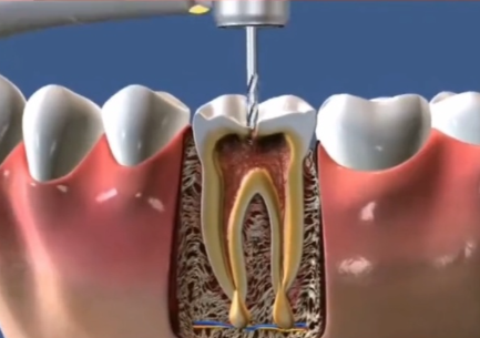北京晴雪园雅德嘉口腔门诊部收费价格表/收费标准