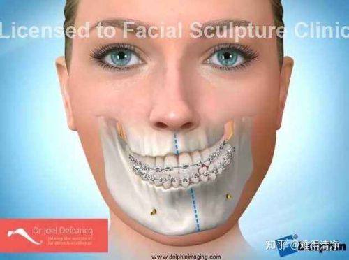 益阳朝阳华美医疗美容门诊部详细的预约挂号方式及流程