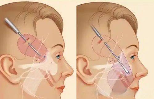 丽水娜美整形美容诊所详细的预约挂号方式及流程