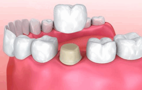 广西崇左博雅口腔地址电话营业时间