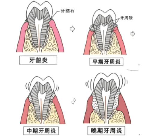 山东威海尹忠植口腔特色项目及技术优势
