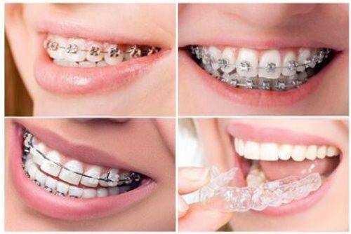 深圳贝齿美口腔(南山门诊)特色项目及技术优势