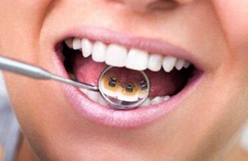 山东威海尹忠植口腔收费价格表/收费标准