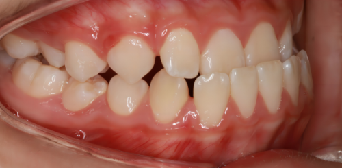 湖南怀化雅贝康口腔门诊部地址电话营业时间