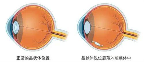 深圳明莱医疗美容诊所是正规医院吗？