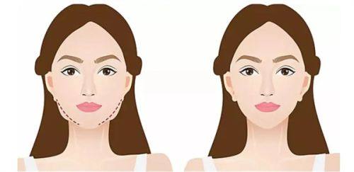 深圳明莱医疗美容诊所收费价格表/收费标准