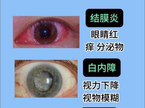 新疆维吾尔自治区维吾尔医医院眼科收费价格表/收费标准