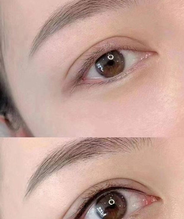 济南麦昆医疗美容诊所真人口碑评价怎么样？