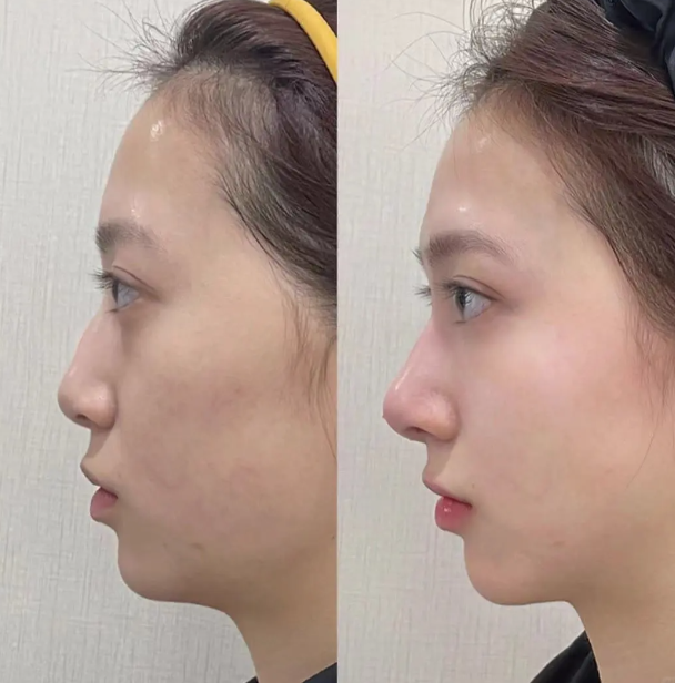 丽水娜美整形美容诊所特色项目及技术优势