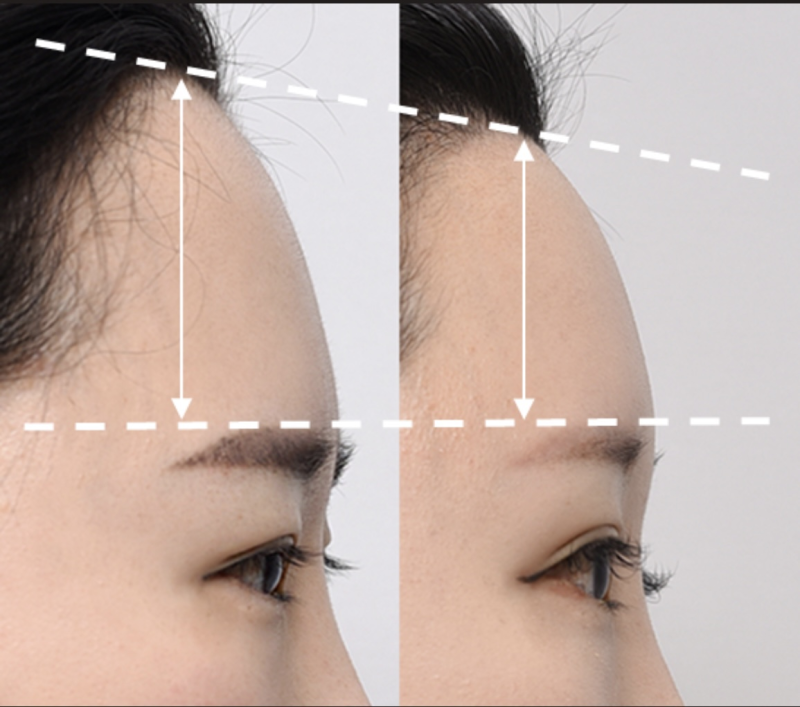 益阳朝阳华美医疗美容门诊部收费价格表/收费标准