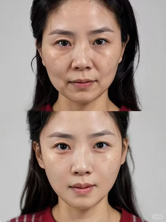 山西临汾现代妇产医院植发科收费价格表/收费标准