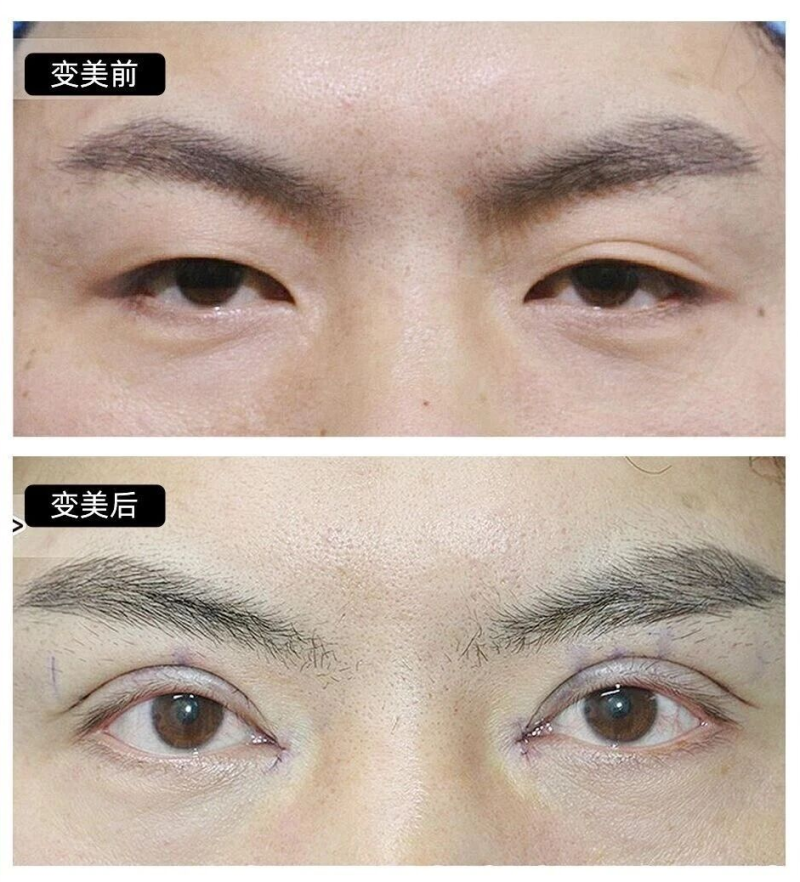 益阳朝阳华美医疗美容门诊部特色项目及技术优势