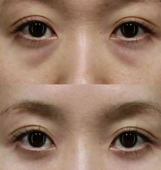 深圳明莱医疗美容诊所详细的预约挂号方式及流程