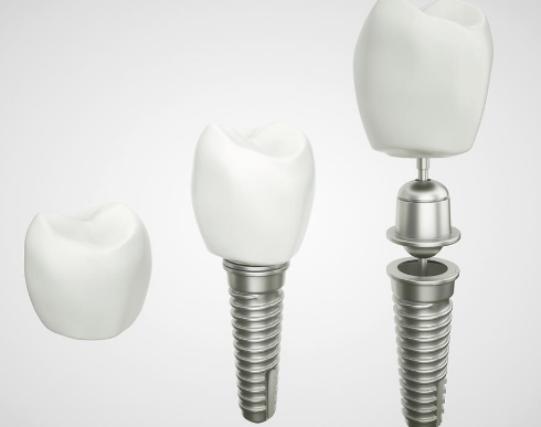 深圳贝齿美口腔(南山门诊)收费价格表/收费标准