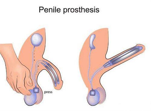 南京天际美容诊所真人口碑评价怎么样？
