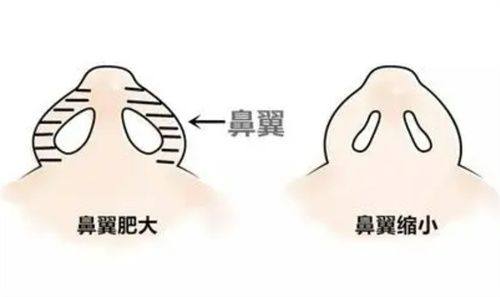 西安铭楠朵美医疗美容诊所真人口碑评价怎么样?