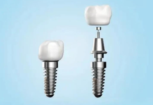 安顺关岭健美口腔诊所特色项目及技术优势