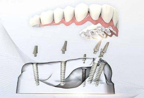 绮云口腔医院是正规医院吗？