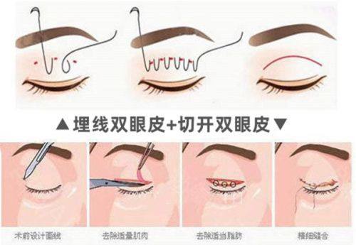 广州皙肤佳整形医院地址电话营业时间