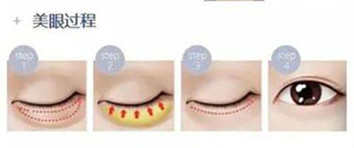 广州军区空军后勤部整形美容中 心地址电话营业时间