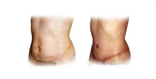 西宁柏晔医疗美容门诊部真人口碑评价怎么样？